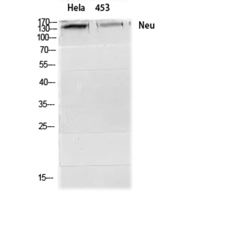 Western blot - Neu Polyclonal Antibody from Signalway Antibody (41218) - Antibodies.com