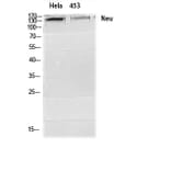 Western blot - Neu Polyclonal Antibody from Signalway Antibody (41218) - Antibodies.com