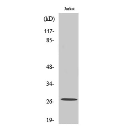 Western blot - NGF Polyclonal Antibody from Signalway Antibody (41239) - Antibodies.com