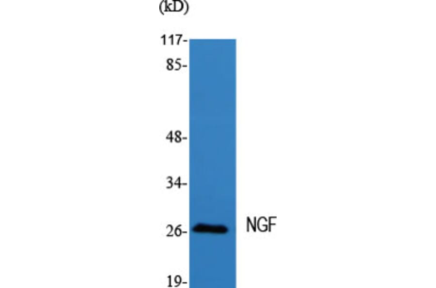 Western blot - NGF Polyclonal Antibody from Signalway Antibody (41239) - Antibodies.com
