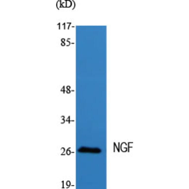 Western blot - NGF Polyclonal Antibody from Signalway Antibody (41239) - Antibodies.com