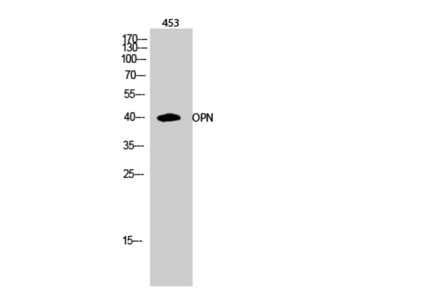 Western blot - OPN Polyclonal Antibody from Signalway Antibody (41290) - Antibodies.com