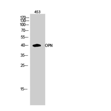 Western blot - OPN Polyclonal Antibody from Signalway Antibody (41290) - Antibodies.com