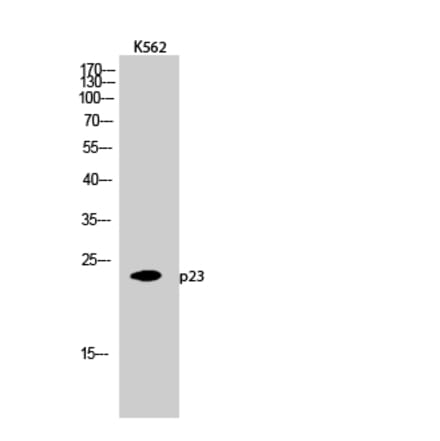 Western blot - p23 Polyclonal Antibody from Signalway Antibody (41298) - Antibodies.com