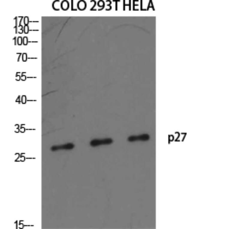 Western blot - p27 Polyclonal Antibody from Signalway Antibody (41299) - Antibodies.com