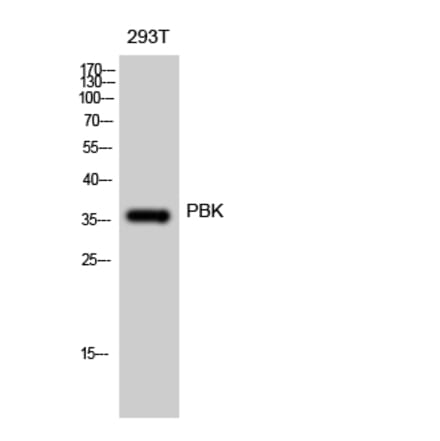 Western blot - PBK Polyclonal Antibody from Signalway Antibody (41325) - Antibodies.com