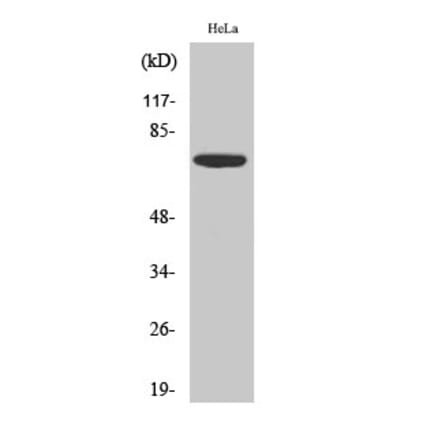 Western blot - PKR Polyclonal Antibody from Signalway Antibody (41350) - Antibodies.com