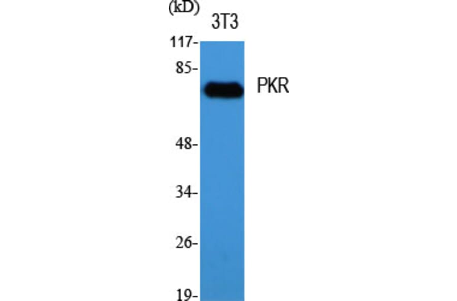 Western blot - PKR Polyclonal Antibody from Signalway Antibody (41350) - Antibodies.com