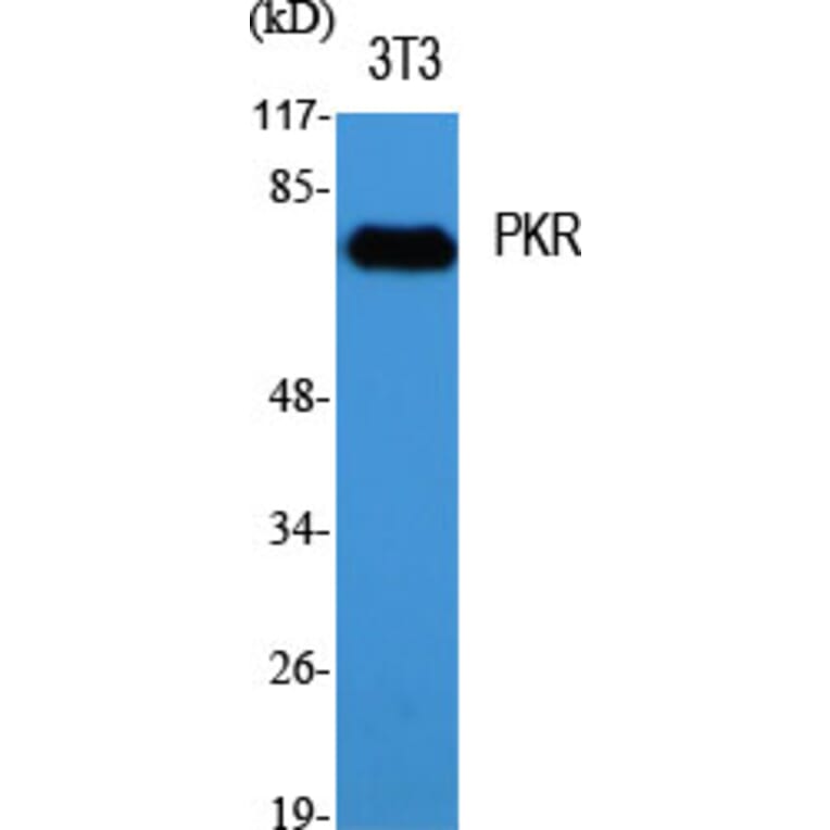 Western blot - PKR Polyclonal Antibody from Signalway Antibody (41350) - Antibodies.com