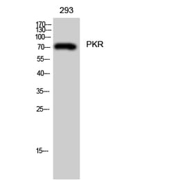 Western blot - PKR Polyclonal Antibody from Signalway Antibody (41351) - Antibodies.com