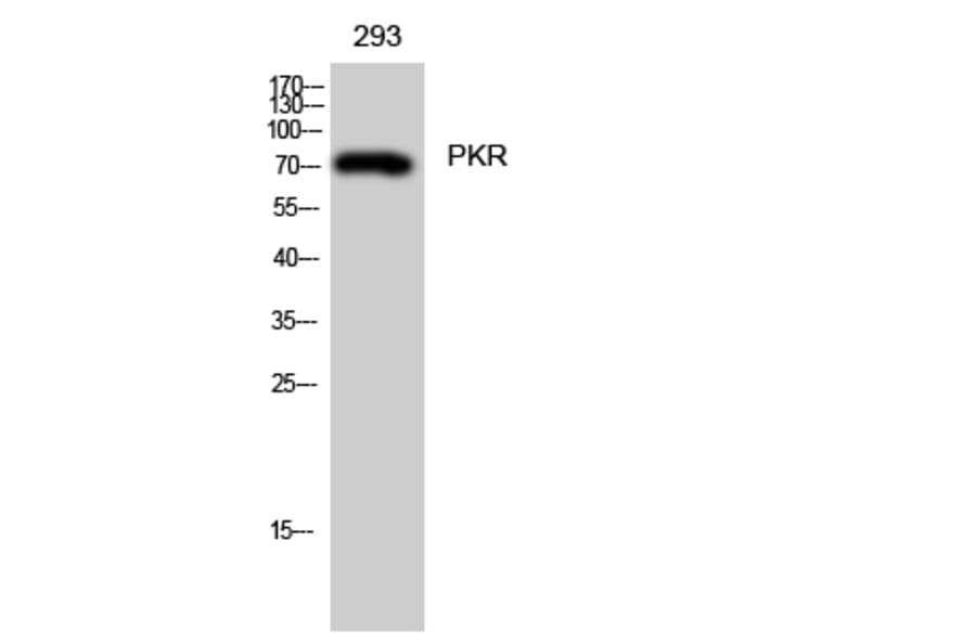 Western blot - PKR Polyclonal Antibody from Signalway Antibody (41351) - Antibodies.com