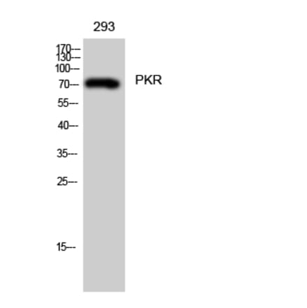 Western blot - PKR Polyclonal Antibody from Signalway Antibody (41351) - Antibodies.com