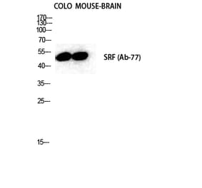 Western blot - SRF Polyclonal Antibody from Signalway Antibody (41459) - Antibodies.com