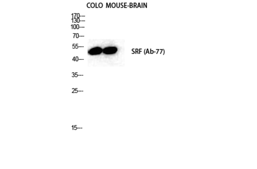 Western blot - SRF Polyclonal Antibody from Signalway Antibody (41459) - Antibodies.com