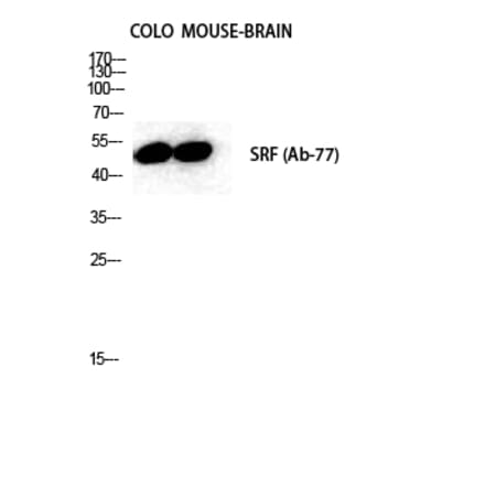 Western blot - SRF Polyclonal Antibody from Signalway Antibody (41459) - Antibodies.com