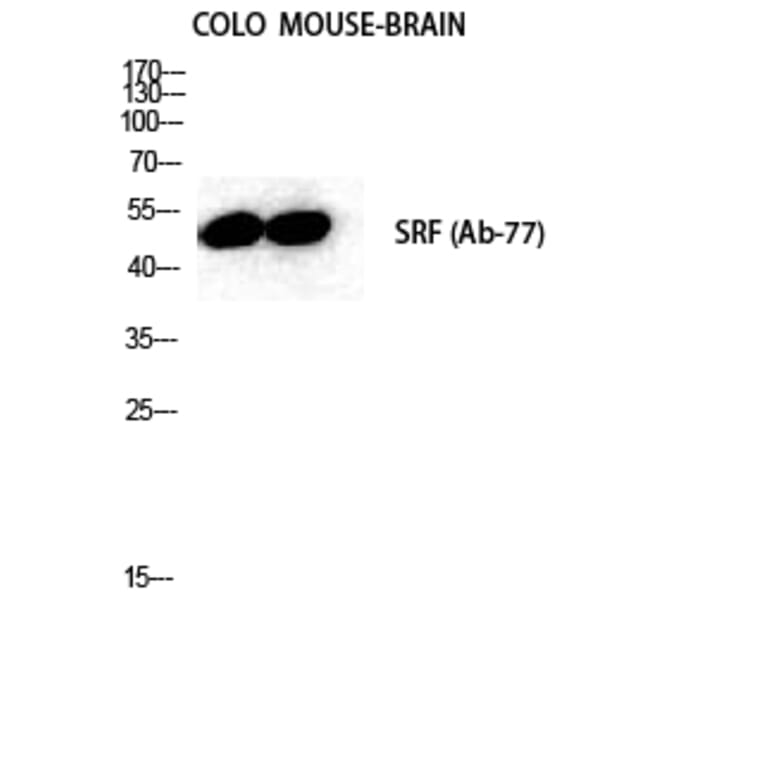 Western blot - SRF Polyclonal Antibody from Signalway Antibody (41459) - Antibodies.com