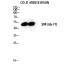 Western blot - SRF Polyclonal Antibody from Signalway Antibody (41459) - Antibodies.com