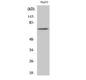Western blot - Syk Polyclonal Antibody from Signalway Antibody (41469) - Antibodies.com