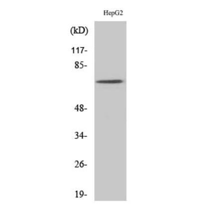 Western blot - Syk Polyclonal Antibody from Signalway Antibody (41469) - Antibodies.com