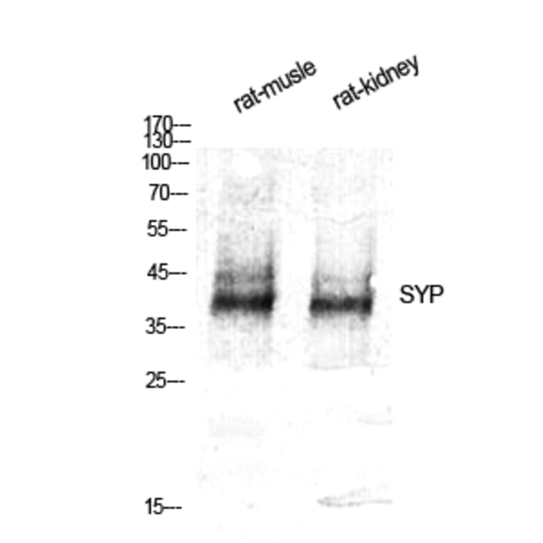 Western blot - SYP Polyclonal Antibody from Signalway Antibody (41475) - Antibodies.com