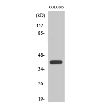 Western blot - XPA Polyclonal Antibody from Signalway Antibody (41537) - Antibodies.com