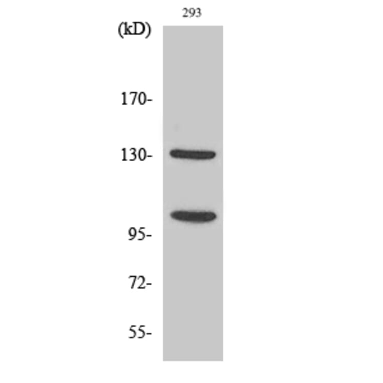 Western blot - Cleaved-Notch 2 (D1733) Polyclonal Antibody from Signalway Antibody (40517) - Antibodies.com