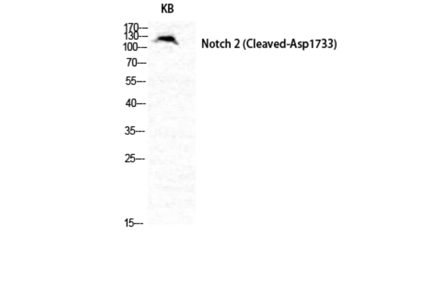 Western blot - Cleaved-Notch 2 (D1733) Polyclonal Antibody from Signalway Antibody (40517) - Antibodies.com