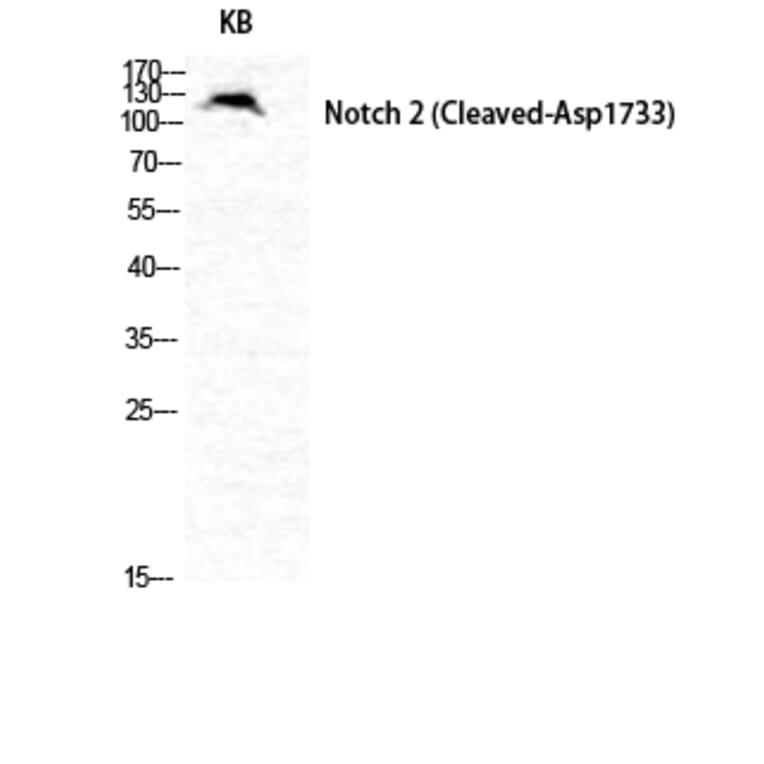 Western blot - Cleaved-Notch 2 (D1733) Polyclonal Antibody from Signalway Antibody (40517) - Antibodies.com