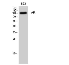 Western blot - AR Polyclonal Antibody from Signalway Antibody (40609) - Antibodies.com