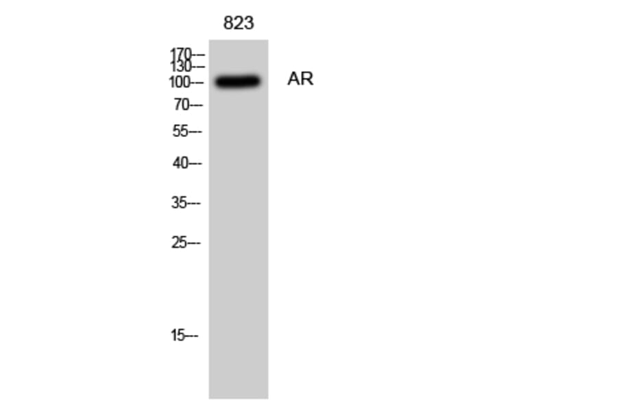 Western blot - AR Polyclonal Antibody from Signalway Antibody (40609) - Antibodies.com
