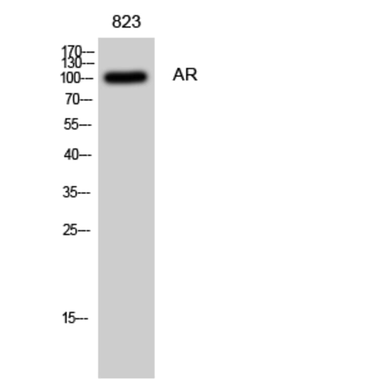 Western blot - AR Polyclonal Antibody from Signalway Antibody (40609) - Antibodies.com