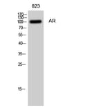 Western blot - AR Polyclonal Antibody from Signalway Antibody (40609) - Antibodies.com