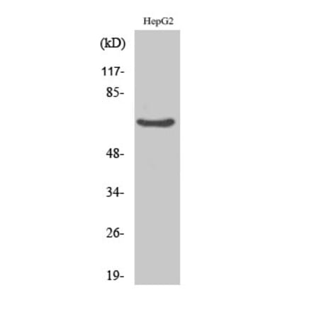 Western blot - IK Polyclonal Antibody from Signalway Antibody (41054) - Antibodies.com