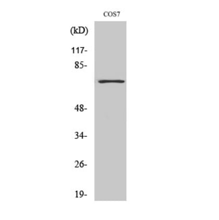 Western blot - Histone deacetylase 10 Polyclonal Antibody from Signalway Antibody (41010) - Antibodies.com