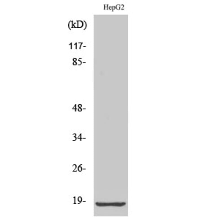 Western blot - Ribosomal Protein L12 Polyclonal Antibody from Signalway Antibody (41400) - Antibodies.com