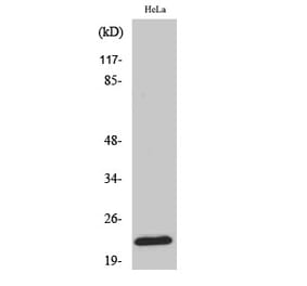 Western blot - Ribosomal Protein L18 Polyclonal Antibody from Signalway Antibody (41402) - Antibodies.com