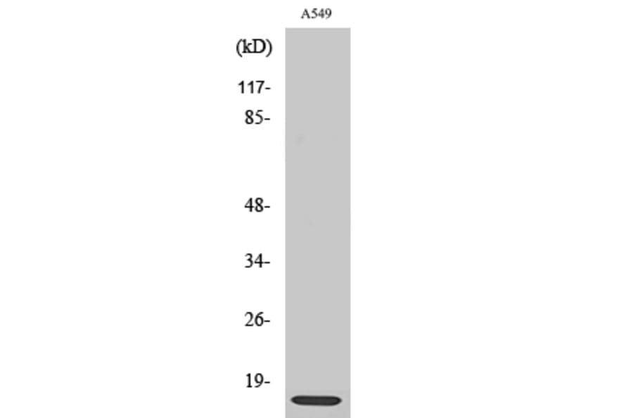 Western blot - Ribosomal Protein L30 Polyclonal Antibody from Signalway Antibody (41406) - Antibodies.com