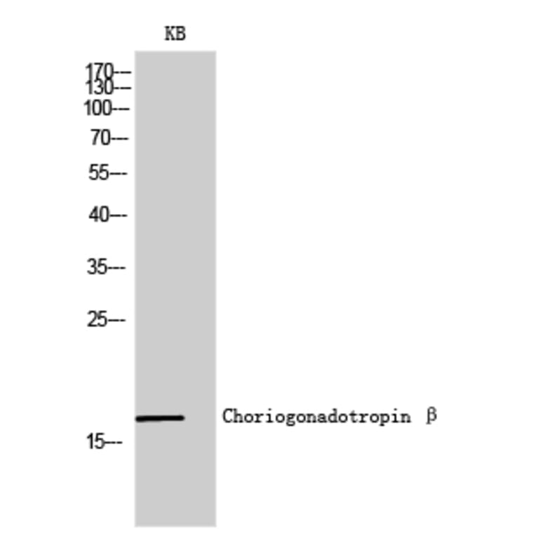 Western blot - Choriogonadotropin β Polyclonal Antibody from Signalway Antibody (40745) - Antibodies.com