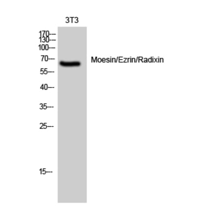 Western blot - Moesin/Ezrin/Radixin Polyclonal Antibody from Signalway Antibody (41161) - Antibodies.com