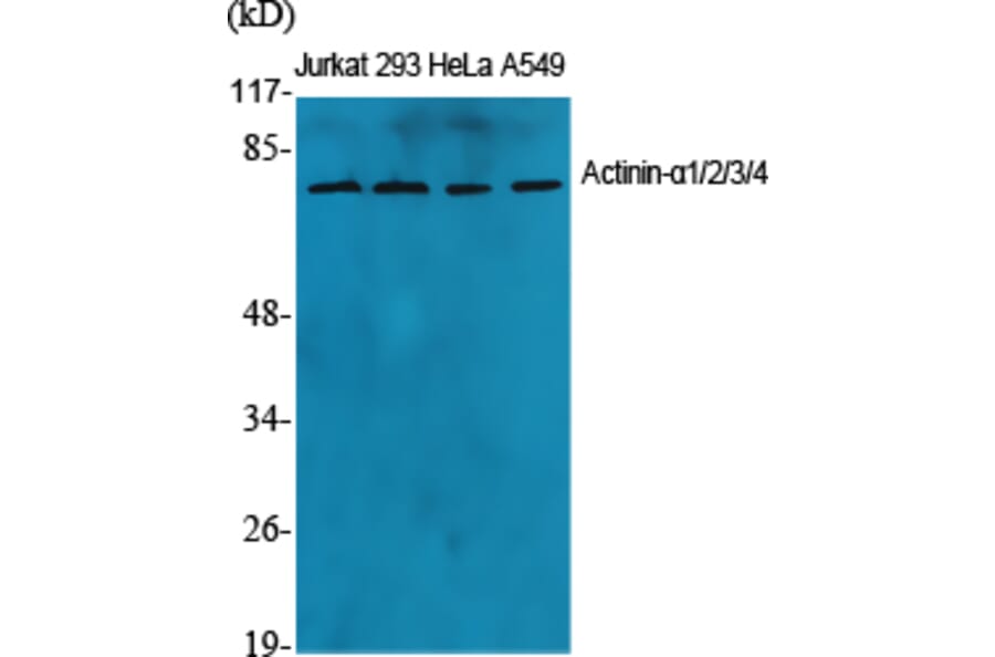 Western blot - Actinin-α1/2/3/4 Polyclonal Antibody from Signalway Antibody (40553) - Antibodies.com