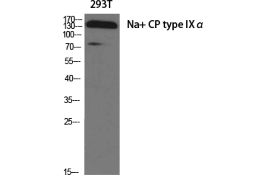 Western blot - Na+ CP type IXα Polyclonal Antibody from Signalway Antibody (41200) - Antibodies.com