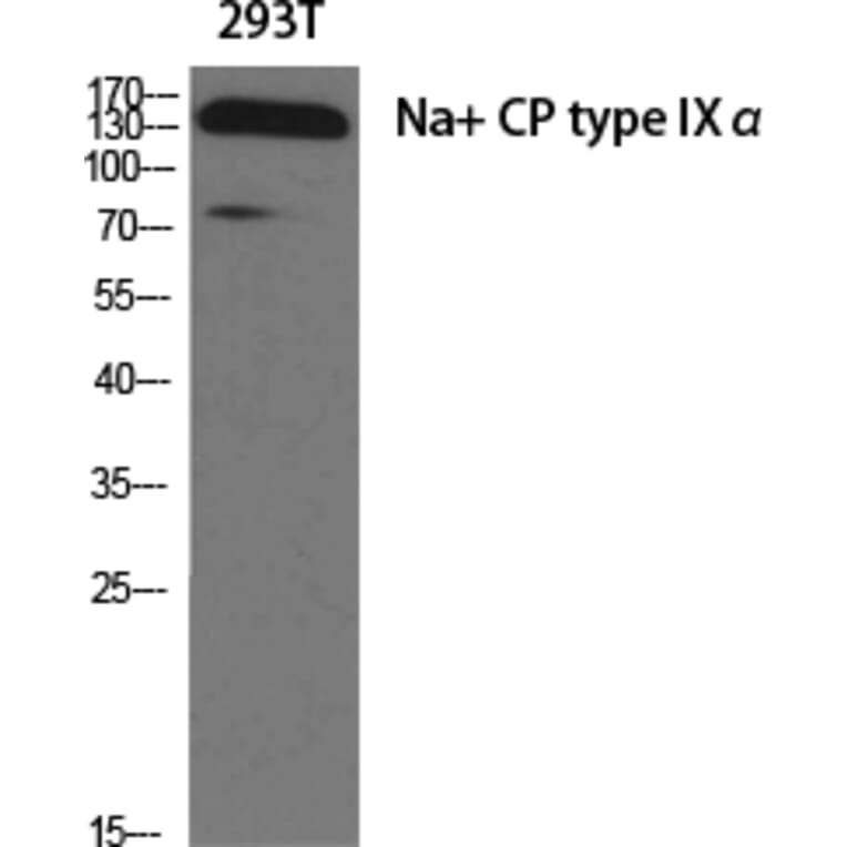 Western blot - Na+ CP type IXα Polyclonal Antibody from Signalway Antibody (41200) - Antibodies.com