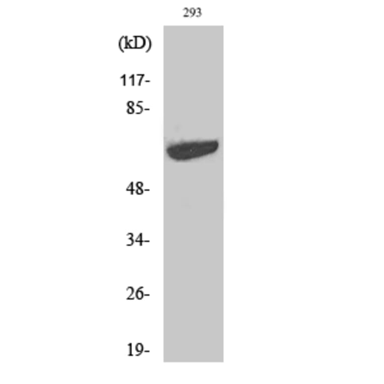 Western blot - p70 S6 kinase α Polyclonal Antibody from Signalway Antibody (41317) - Antibodies.com