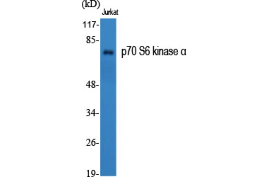 Western blot - p70 S6 kinase α Polyclonal Antibody from Signalway Antibody (41317) - Antibodies.com