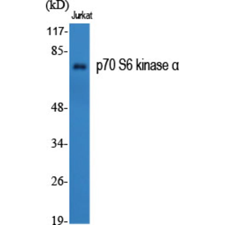 Western blot - p70 S6 kinase α Polyclonal Antibody from Signalway Antibody (41317) - Antibodies.com