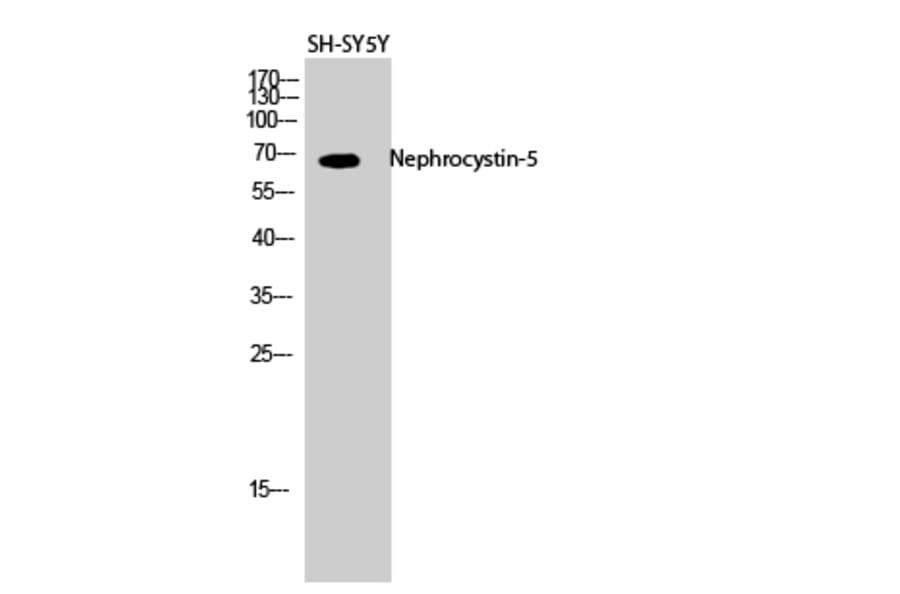Western blot - Nephrocystin-5 Polyclonal Antibody from Signalway Antibody (41213) - Antibodies.com