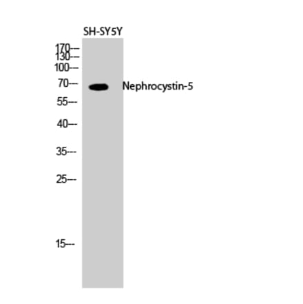 Western blot - Nephrocystin-5 Polyclonal Antibody from Signalway Antibody (41213) - Antibodies.com