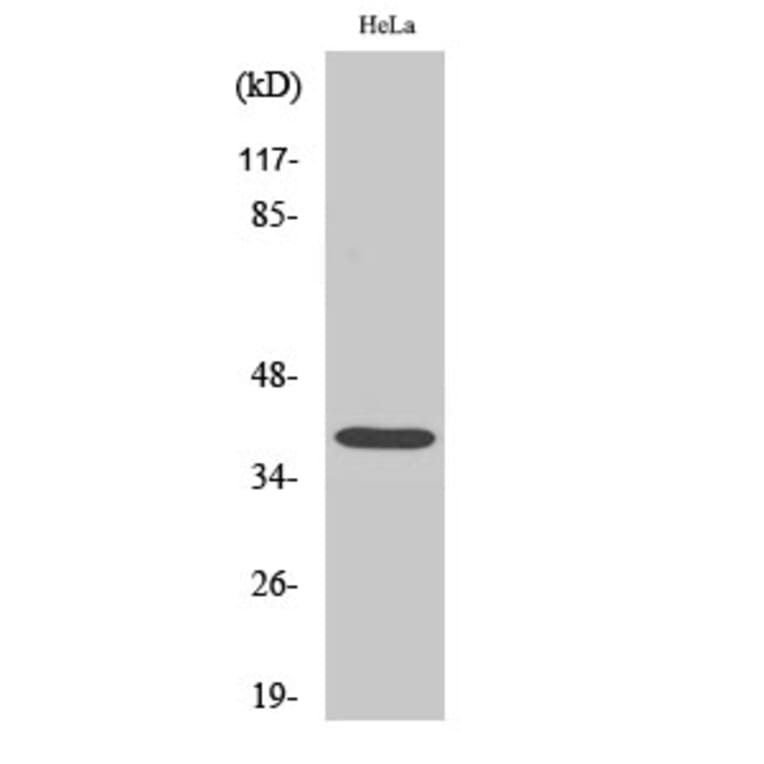 Western blot - Nucleophosmin Polyclonal Antibody from Signalway Antibody (41258) - Antibodies.com