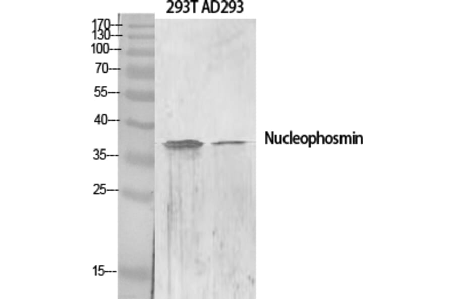 Western blot - Nucleophosmin Polyclonal Antibody from Signalway Antibody (41258) - Antibodies.com