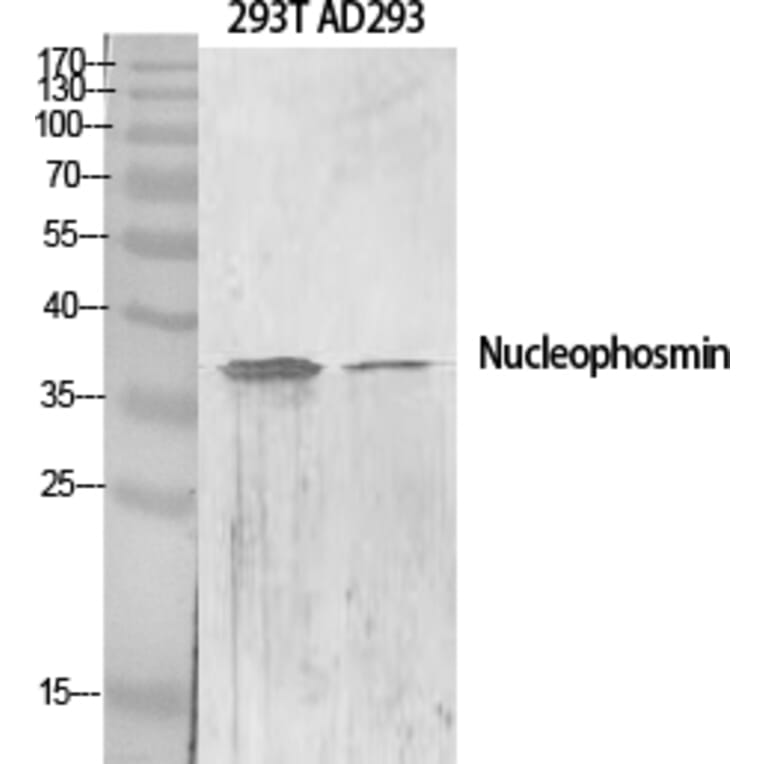 Western blot - Nucleophosmin Polyclonal Antibody from Signalway Antibody (41258) - Antibodies.com